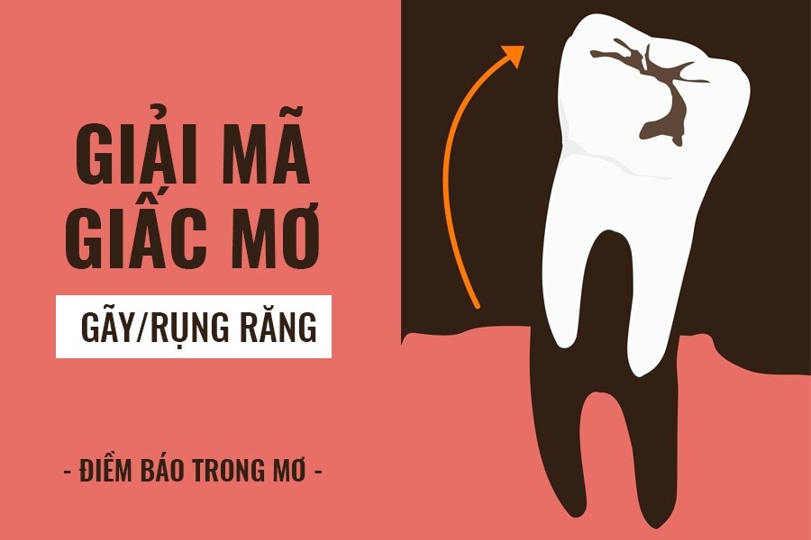 0655 Giai Mac Giac Mo Gay Rang Anh Dai Dien